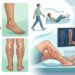 4 síntomas de mala circulación visibles en las piernas