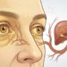 Ojos y piel con tono amarillento: ¿qué significa?