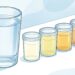 Cuántos vasos de agua al día se consideran adecuados para la mayoría de los adultos