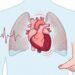 Problemas en el corazón: cómo reconocer los primeros síntomas