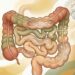 Síndrome del intestino irritable: conoce los síntomas, las causas y los tratamientos