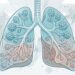 Enfermedad pulmonar: qué lleva a la pérdida de la función de los pulmones
