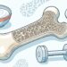 Cómo favorecer la salud ósea de forma natural para fortalecer los huesos y prevenir fracturas