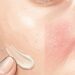 Cuántas veces por semana es normal exfoliar la piel para cuidar y proteger el rostro