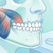 Ilustración médica detallada de una mandíbula humana que muestra los músculos de la masticación en tonos azules y rojizos, junto a una férula de descarga transparente colocada sobre una superficie para el tratamiento del bruxismo.