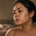 Mujer joven observándose en un espejo con acné en la barbilla y vello facial visible, signos frecuentemente asociados al síndrome de ovario poliquístico.