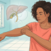 Ilustración de una mujer rascándose el brazo sin lesiones visibles, junto a un gráfico anatómico del hígado y la vesícula biliar.