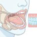 Sensación de boca seca, sed constante o saliva espesa: ¿qué significan estas señales del cuerpo?