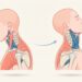 Dolor de cuello: la actividad recomendada para reducir el dolor y evitar que se vuelva crónico