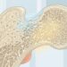 Osteoporosis: 5 hábitos que ayudan a proteger los huesos y a prevenir el problema