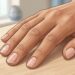 Las uñas son uno de los lugares donde se pueden notar señales de la salud del cuerpo