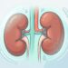 Estos hábitos cotidianos pueden acabar con la salud renal