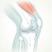 Artrosis de rodilla en foco: sus causas y cómo aliviar el dolor