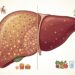 Hábitos diarios para preservar la salud del hígado y prevenir el hígado graso