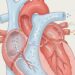 Alimentos que ayudan a cuidar la salud del corazón, según la ciencia