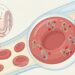 Qué comer para ayudar a reducir el riesgo de anemia por falta de hierro