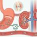Ibuprofeno o naproxeno: en qué se diferencian y por qué conviene consultar antes de usarlos