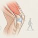 Dolor de rodilla: la actividad recomendada para reducir el dolor y mantener la movilidad