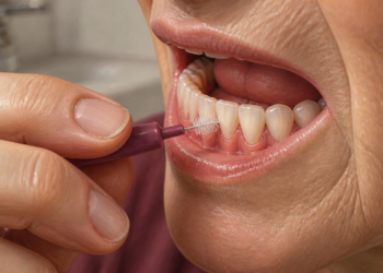 Persona mayor utilizando un cepillo interdental entre los dientes inferiores, con las encías y la zona dental visibles en primer plano.