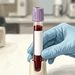 Mano con guante azul sostiene un tubo de extracción con muestra de sangre en un entorno de laboratorio, junto a una gradilla con otros tubos al fondo.