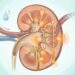Reducir alimentos ricos en sodio ayuda a proteger los riñones y controlar la presión arterial.
