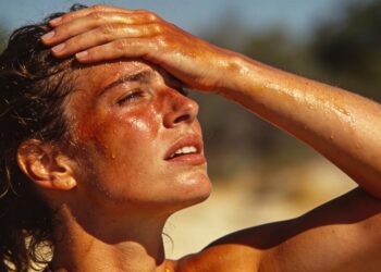 Esses sintomas indicam que o calor pode estar causando insolação