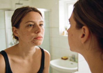 Saber identificar a acne certa muda totalmente o tratamento e evita danos maiores