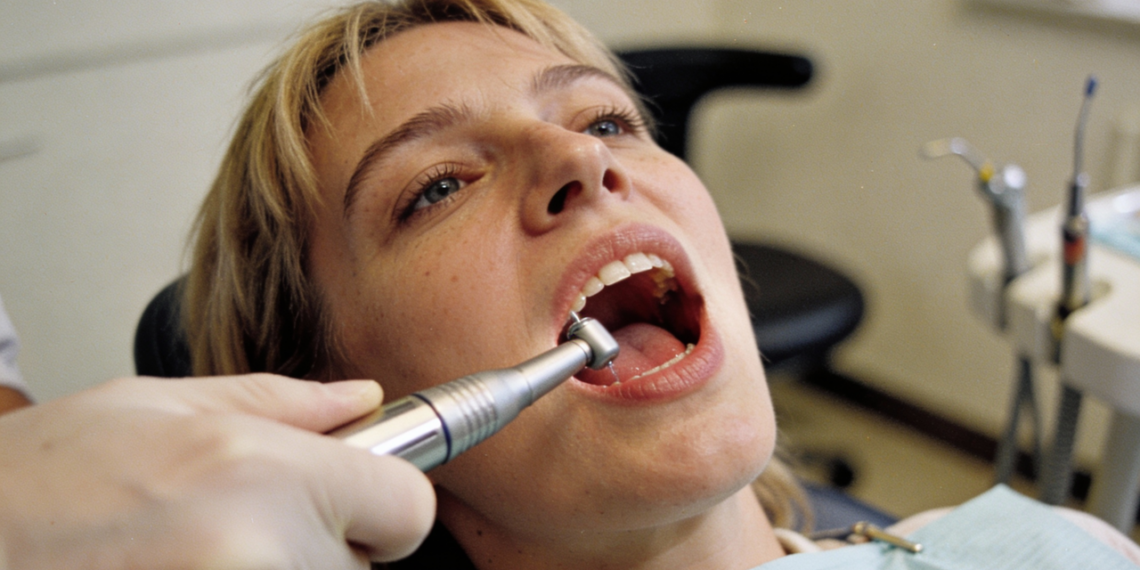 O que faz a placa virar tártaro mesmo com escovação?