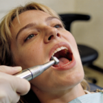 O que faz a placa virar tártaro mesmo com escovação?