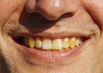 Por que os dentes ficam amarelos mesmo com higiene em dia?