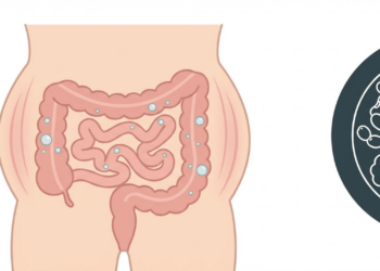 Você solta muitos gases? Mostramos qual é a quantidade saudável