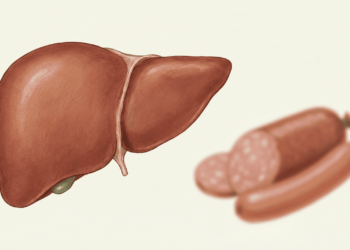 Quais são os efeitos do consumo de linguiça, presunto, chouriço e outras carnes processadas em pessoas com doença hepática gordurosa?