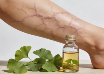 Planta milenar que pode ajudar a reduzir a inflamação das varizes e diminuir a formação de coágulos