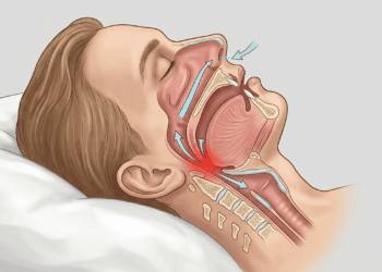 Ronco não é apenas barulho incômodo e os 3 níveis de gravidade explicam por quê