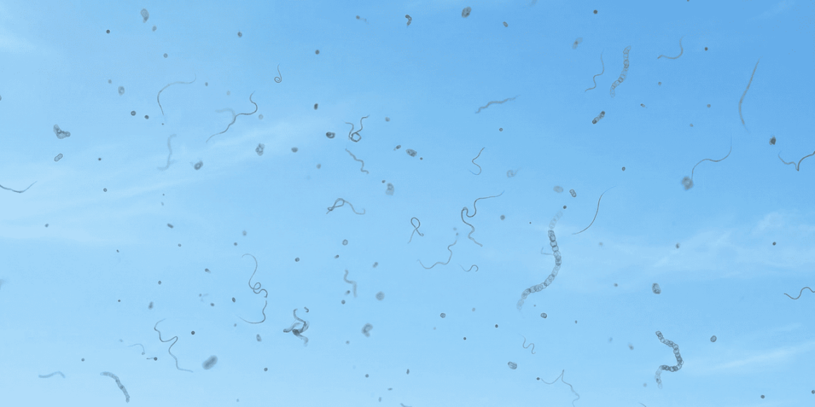 Você vê pequenos pontos ou fios flutuantes diante dos seus olhos? Essa pode ser a razão