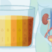 O que a cor da sua urina pela manhã revela sobre o seu metabolismo