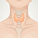 Como saber se tenho problema na tireoide? Aqui estão os sintomas e os exames