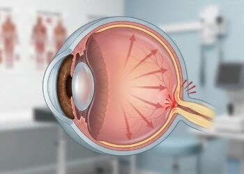 Glaucoma pode causar cegueira irreversível e muitas pessoas não sabem que têm a doença
