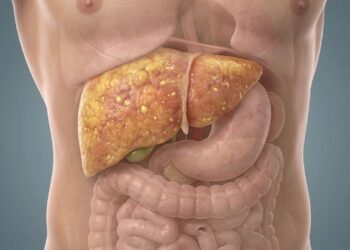 Barriga estufada no fim do expediente? saiba se o problema é apenas má digestão ou fígado sobrecarregado (esteatose)