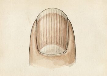 Unhas com linhas verticais ao acordar? O sinal claro de que o seu corpo não está absorvendo colágeno e vitaminas