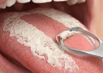 7 maneiras eficazes de se livrar do mau hálito persistente na raiz do problema