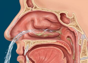 7 maneiras eficazes de se livrar da congestão nasal crônica sem depender de descongestionantes