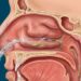 7 maneiras eficazes de se livrar da congestão nasal crônica sem depender de descongestionantes