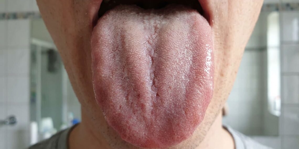 Estudo alerta por que limpar a língua ao acordar faz diferença