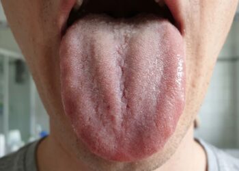 Estudo alerta por que limpar a língua ao acordar faz diferença