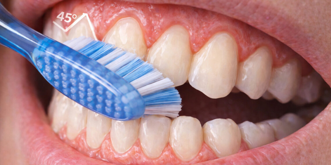 Como escovar os dentes corretamente e por que a pressão da escova faz tanta diferença