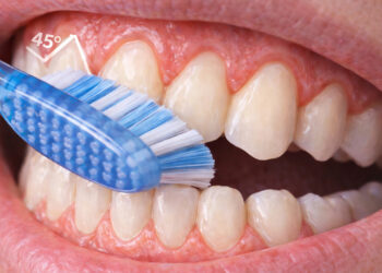 Como escovar os dentes corretamente e por que a pressão da escova faz tanta diferença