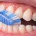 Como escovar os dentes corretamente e por que a pressão da escova faz tanta diferença