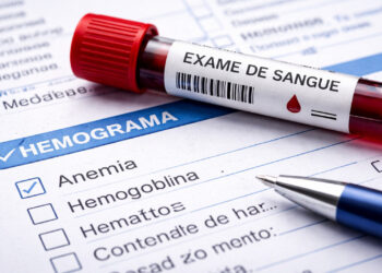 Como saber se tenho anemia? Aqui estão os sintomas e os exames
