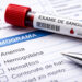 Como saber se tenho anemia? Aqui estão os sintomas e os exames